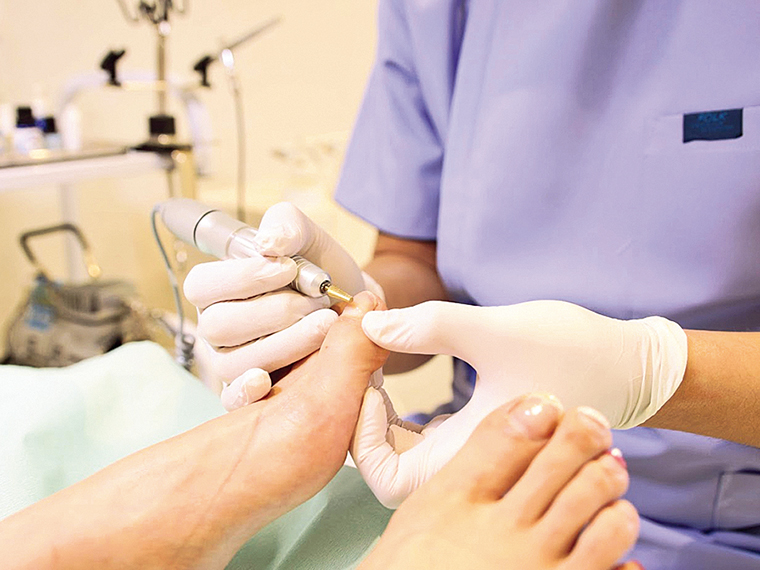 巻き爪の施術時間は1回30分程度。HPで症例のチェックや24時間予約できる